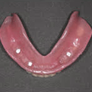 下の義歯の裏側にマグネットにひっつくキーパーがあり口腔内で